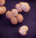 klebsiella-pneumoniae-ss-pneumoniae