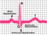 elektrokardiogram-ekg