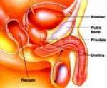 Upala prostate (Prostatitis)