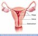 endometrijalni-polip