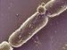 bacillus-anthracis