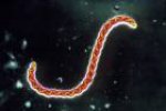 leptospira-interrogans