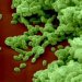 haemophilus-influenzae