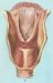 flegmonozni-laringitis-i-apsces-larinksa
