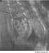 adrenogenitalni-sindrom