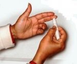 test-za-brzo-otkrivanje-hiv-virusa