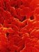 mycobacterium-tuberculosis