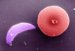toxoplasma-gondii
