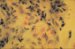 mycobacterium-leprae