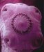 hymenolepis-nana