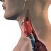 subakutni-tireoiditis