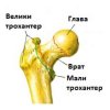 Butna kost: anatomija, klinička slika i lečenje butna-kost-anatomija-klinička-slika-i-lečenje