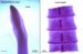 diphyllobothrium-latum
