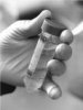 novi-lek-protiv-hiv-a-ohrabrujuće-efikasan