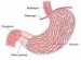 infantilna-hipertrofična-stenoza-pilorusa