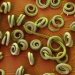 trichinella-spiralis
