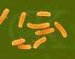trovanje-hranom-uzročnik-clostridium-perfrigens