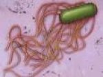 salmoneloze-salmonellosis