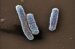 legionella