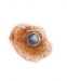 virus-varicellae