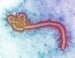ebola
