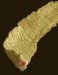 dipylidium-caninum