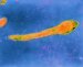 actinomyces-israelii
