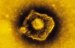varicella-zoster-virus