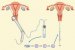 ivf-metoda