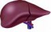 hepatitis-b
