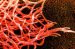 nocardiae