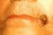 cornu-cutaneum