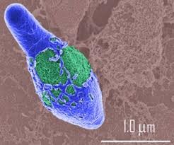 clostridium-perfringens