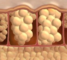 masne-ćelije