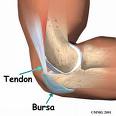 Burzitis (Bursitis)