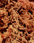 Klebsiella