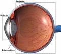 Uveitis