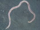 Strongyloides stercoralis