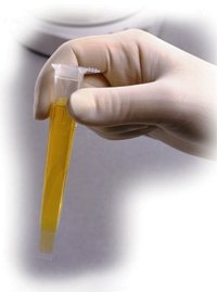 Pregled urina