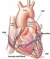 Zakrčenje krvnih sudova srca