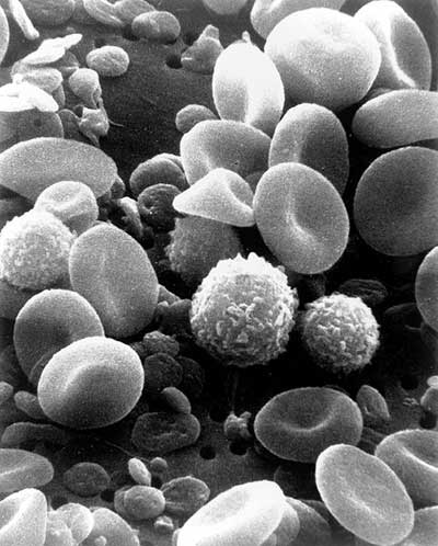 Leukociti - bela krvna zrnca