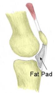 patellofemoral artroza kolena