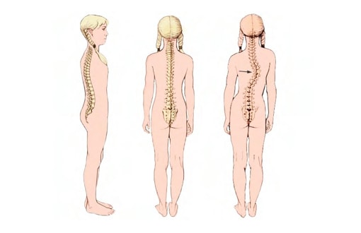 Vodič za rano otkrivanje skolioze