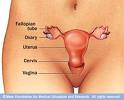 Vaginitis (zapaljenje vagine)