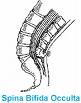 Okultna spina bifida