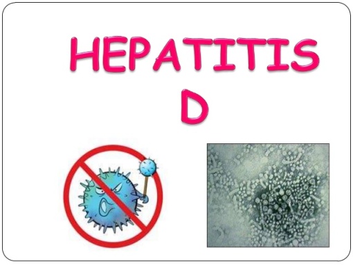 Hepatitis D