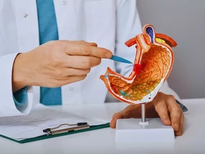 Petički ulkus (čir) - nastanak i lečenje Peptički ulkus ili čir predstavlja ograničeno oštećenje sluznice želuca ili dvanaestopalačnog creva (duodenuma) koje zahvata sluznicu i prodire u dubinu zida.