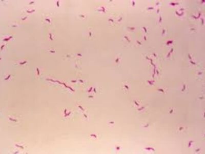 Campylobacter je veoma sitan, u obliku zapete izrazito pokretan i Gram negativan bacil. Bakterija prianja uz zid creva, razara ga i proizvodi toksin koji izaziva bolest. Izvor zaraze za čoveka su domaće životinje (ovce, koze, krave, psi i dr.).
