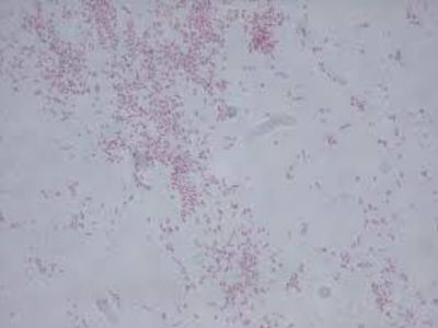 Rod Citrobacter je klasifikovan u porodicu Enterobacteriaceae. Citrobacter je Gram negativan bacil, nepravilno raspoređen u polju i ne može se pod mikroskopom razlikovati od ostalih Enterobacteriaceae.