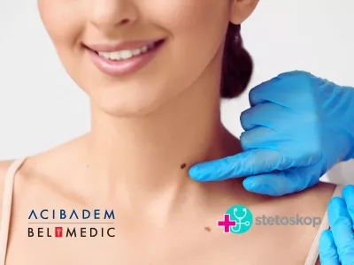 Dermoskopski pregled jednom godišnje preporučuje se svim odraslim osobama, a posebno osobama sa svetlom kožom i pozitivnom porodičnom anamnezom za melanom.
